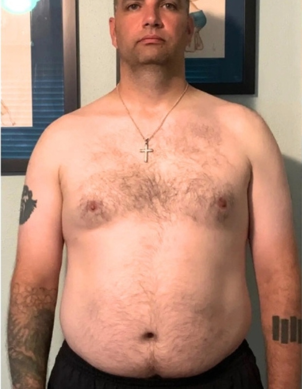 Richard P. before